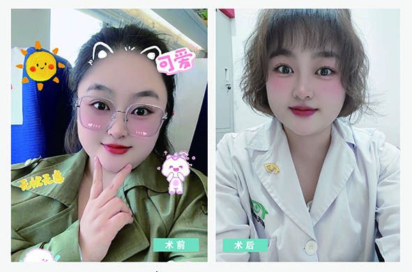 营口何氏眼科医院员工摘镜日记   第九期